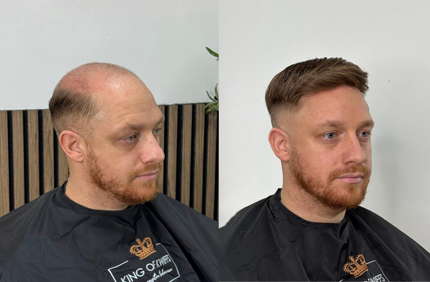 Re-Gen hair systems before and after transformation